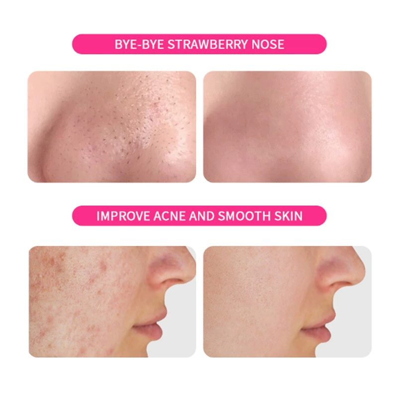 LBLS Niacinamide Cherry Blossom Handcrafted Soap 70 g