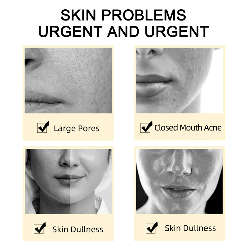 LBLS Exfoliating Toner