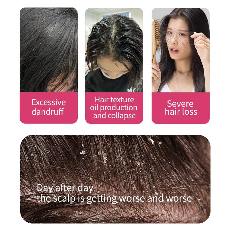 LBLS Onion Rosemary Shampoo