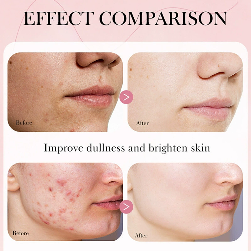 LBLS Collagen Serum