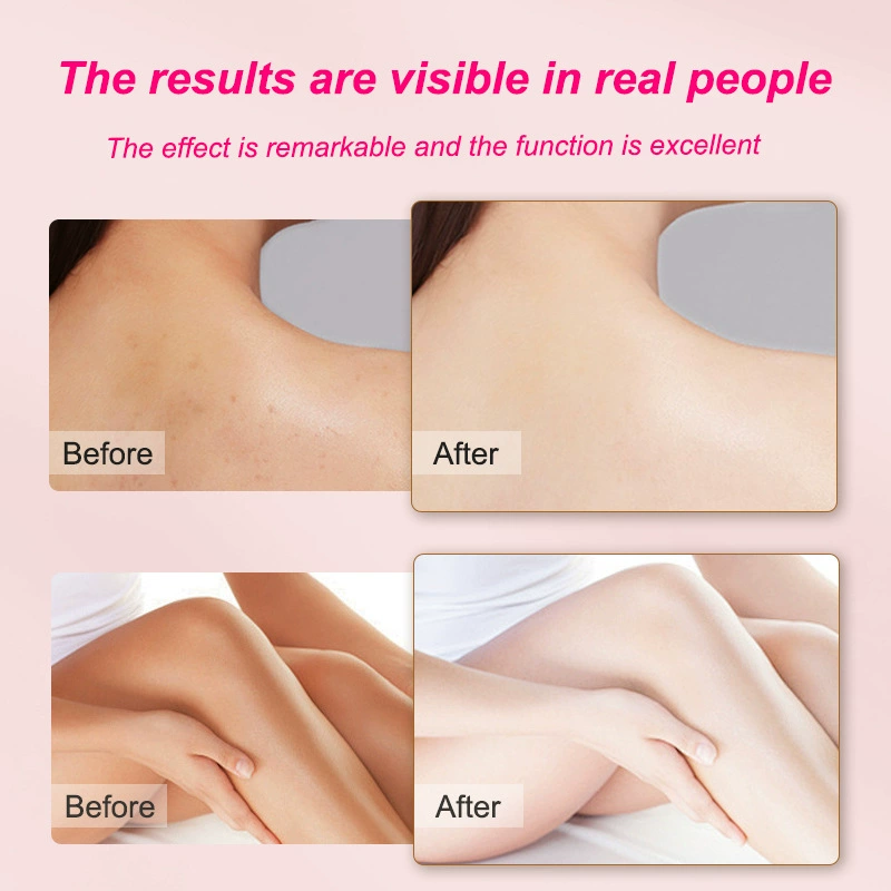 LBLS Niacinamide Brightening