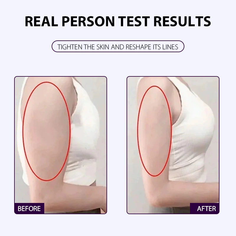 LBLS Firming Arm Cream